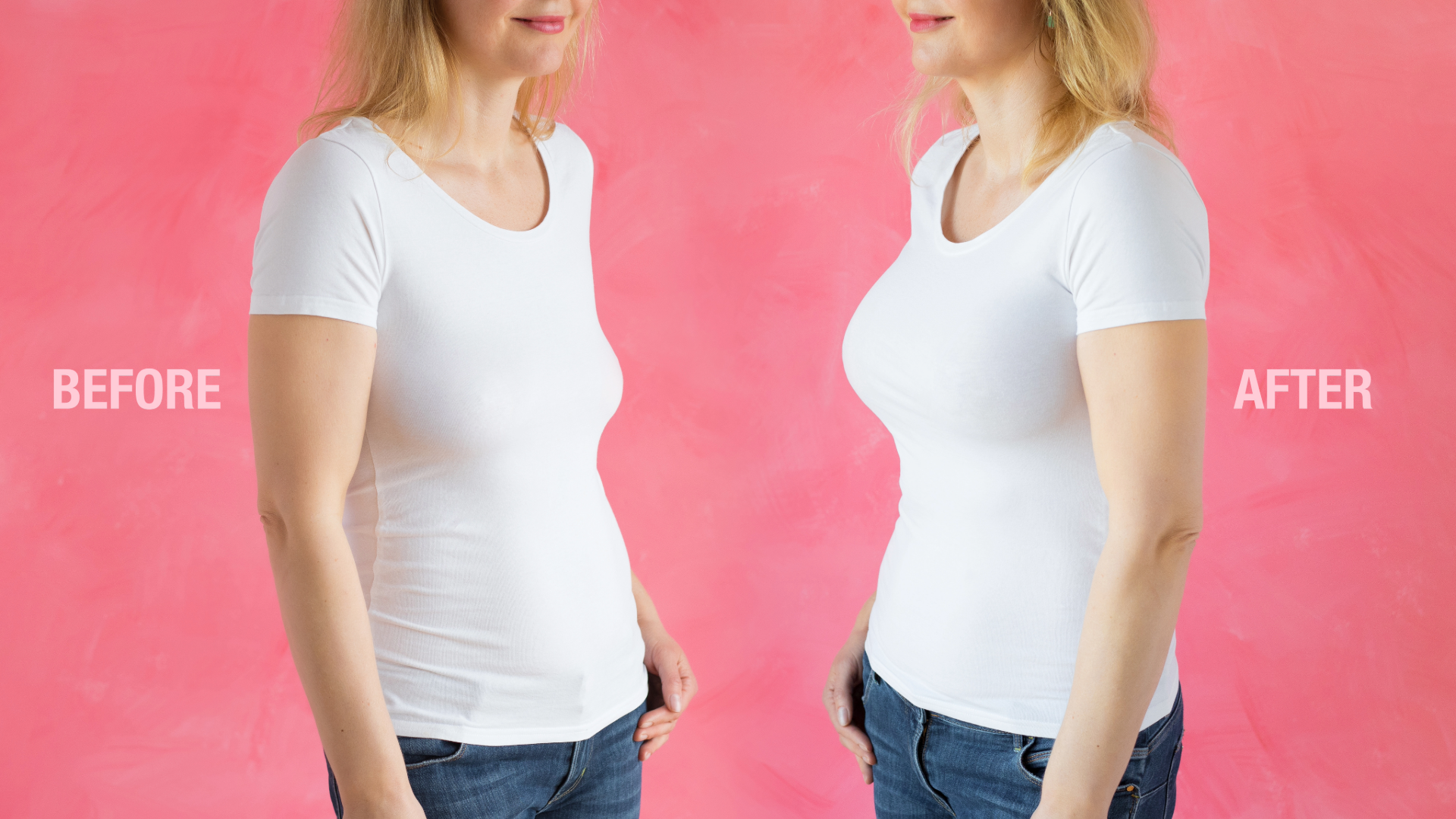 Rise in “Mommy Makeover” surgery addressed