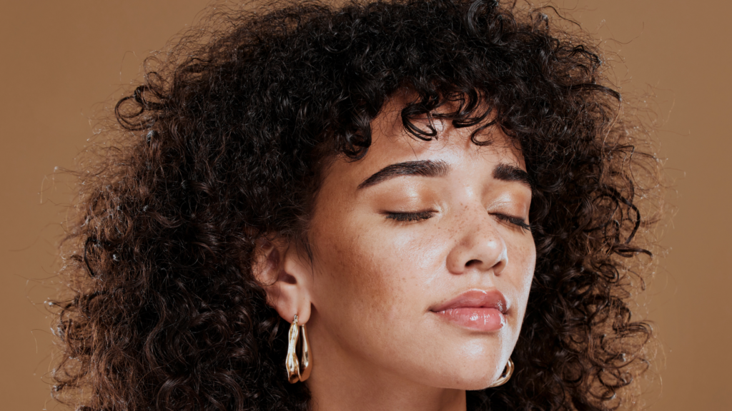 Melasma