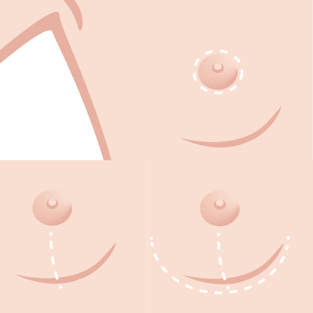 Different-types-of-scars