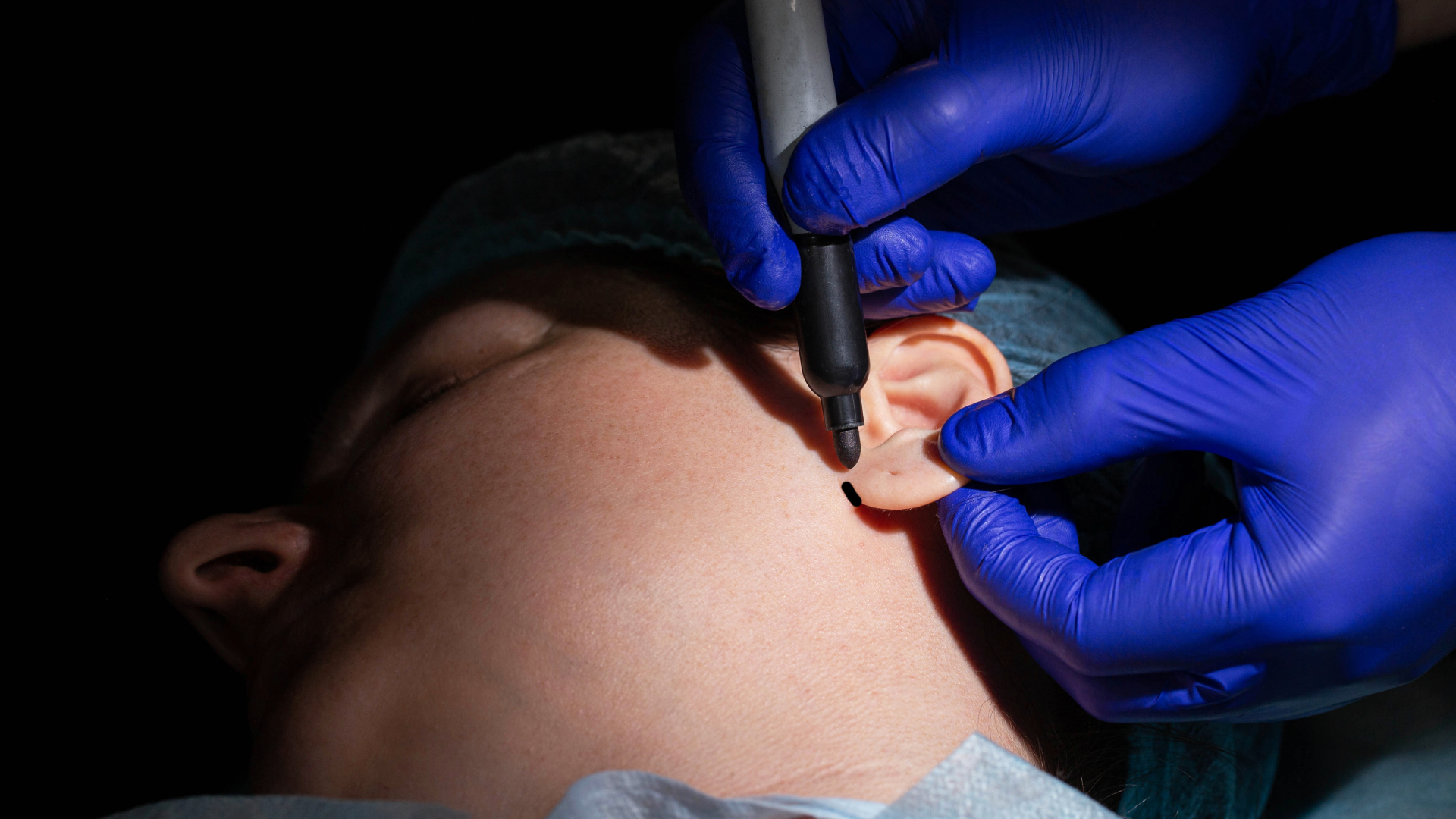 Split Earlobe Repair