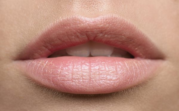 lip fillers