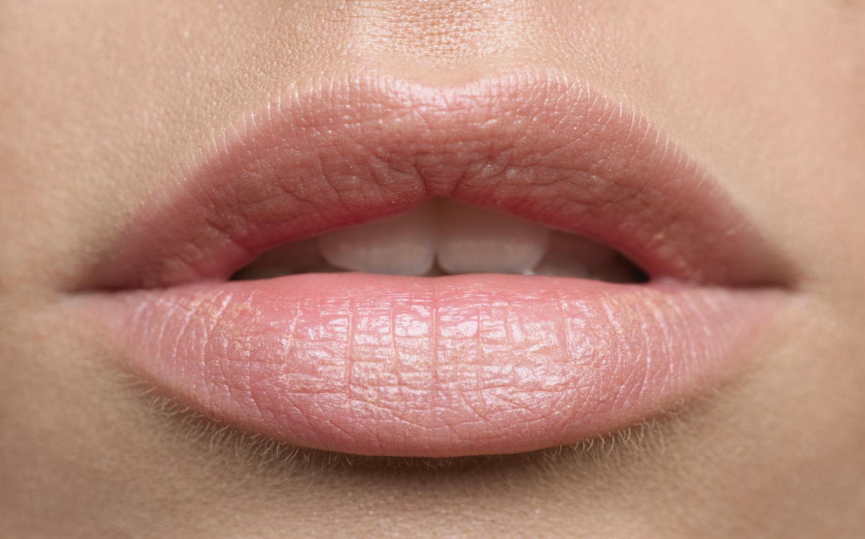 Are lip fillers right for you?