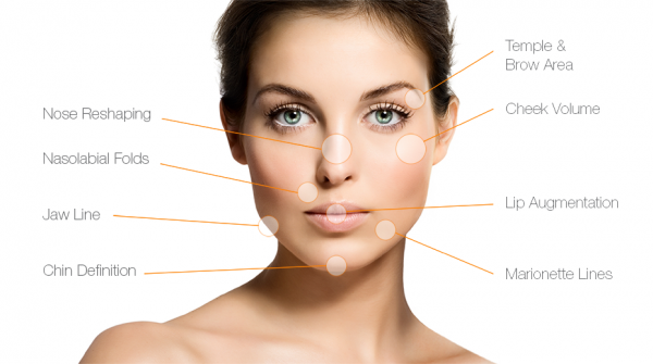 dermal fillers