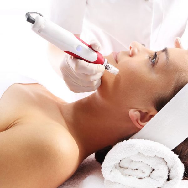 micro needling