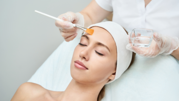 Chemical Peel in clinic