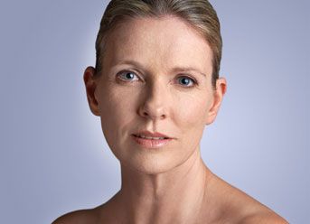 facelift