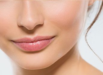 upper lip lift in london