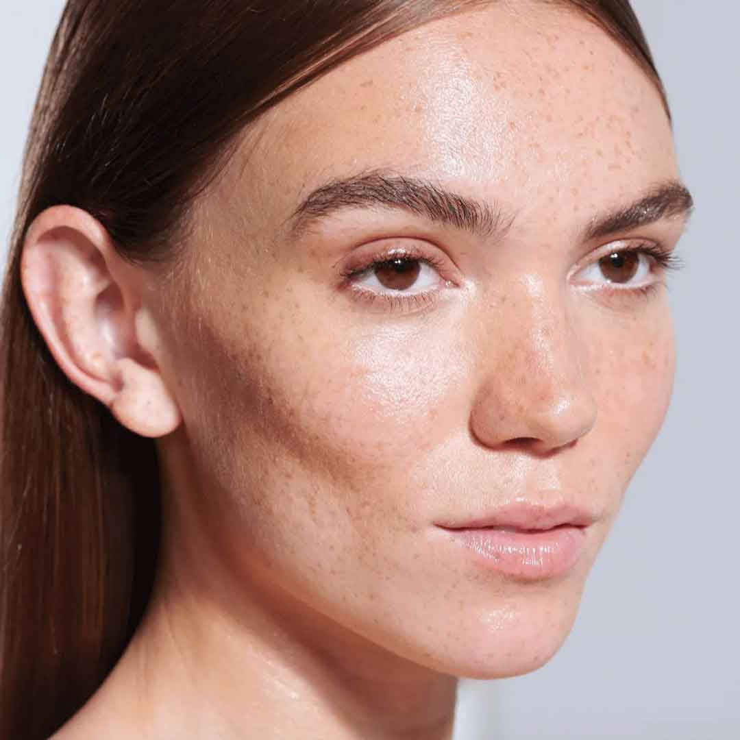 Facial Aesthetic