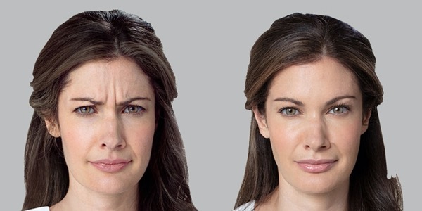Botox Injections & Treatments Harley Street London Botox Injections & Treatments Harley Street London