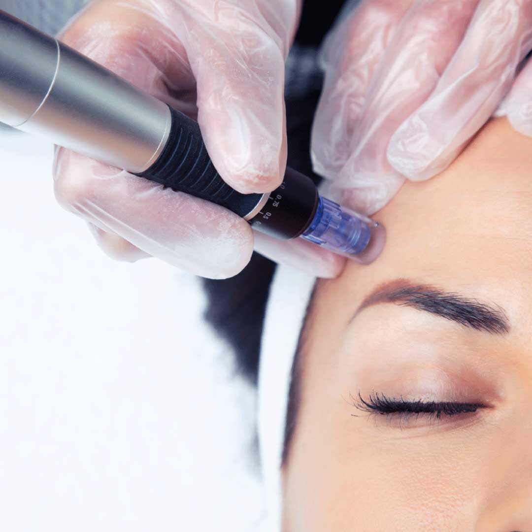 Dermapen