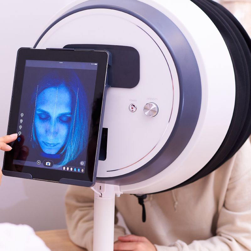 UV Skin Scanner