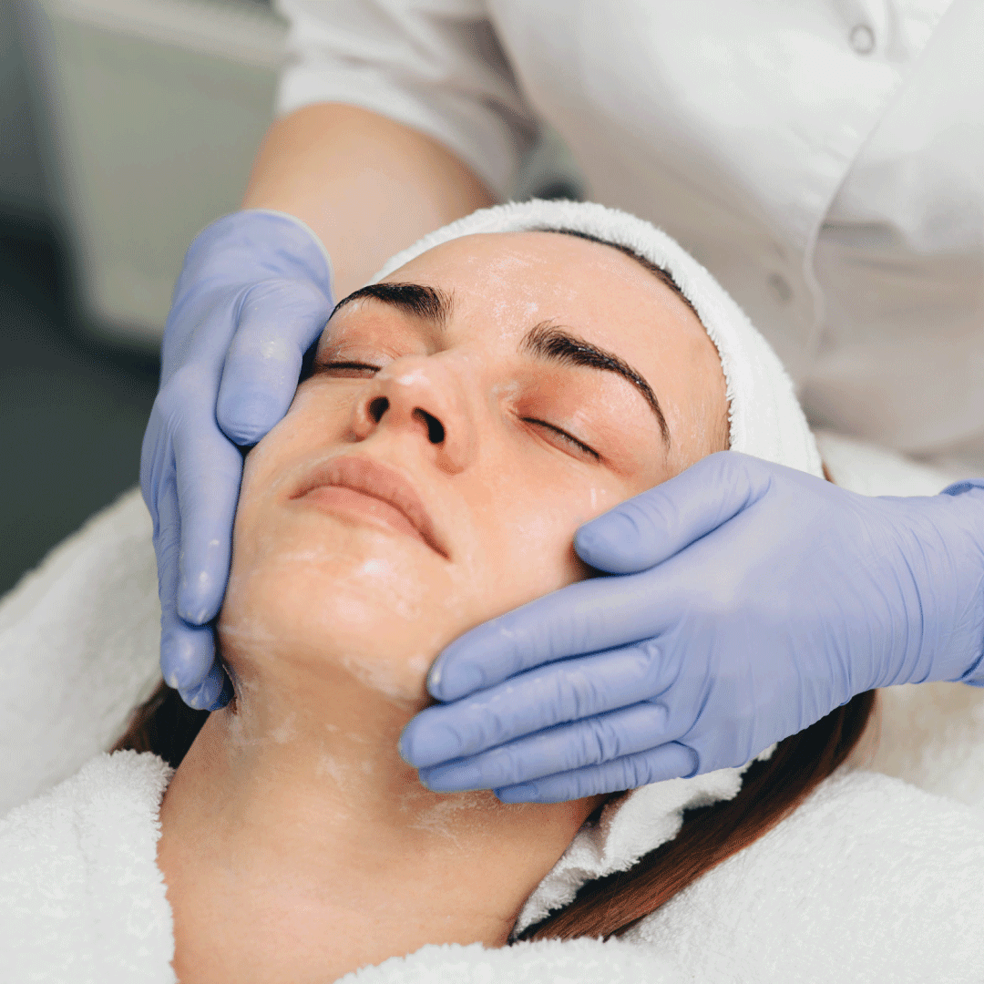 Chemical Skin Peels