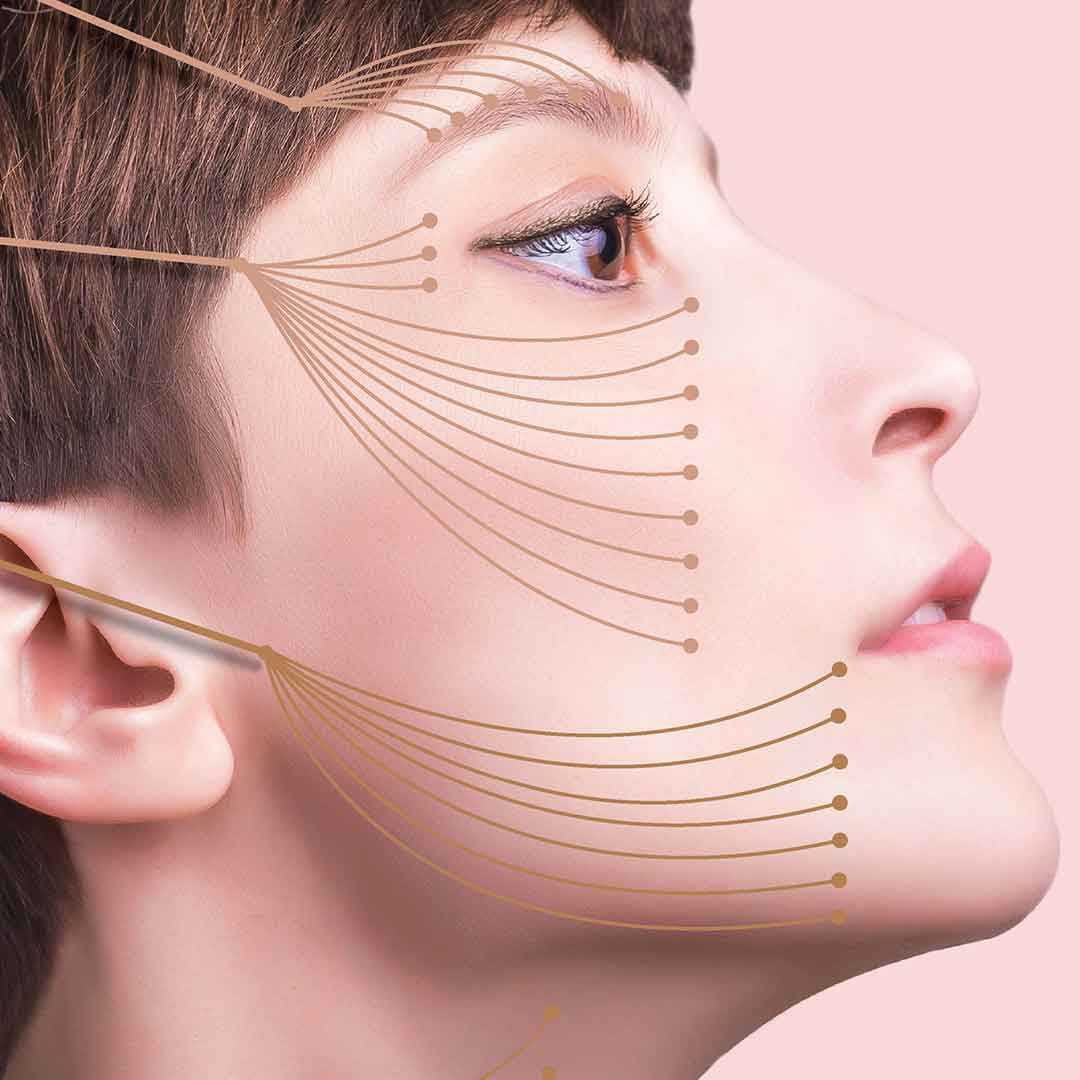 Soft Thread Lift