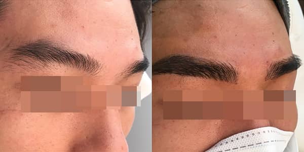 Korean Microblading Eyebrows London