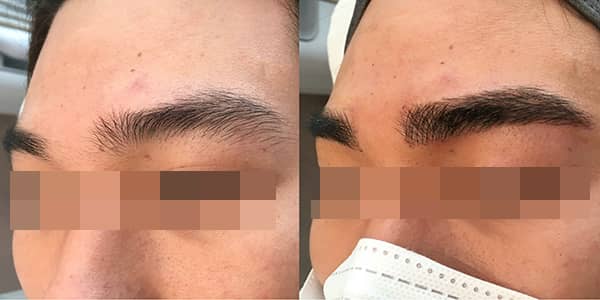 Korean Microblading Eyebrows London