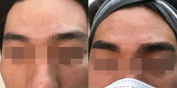 Korean Microblading Eyebrows London