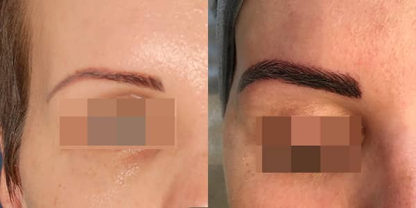 London Cosmetic Tattooing - Eye Brow