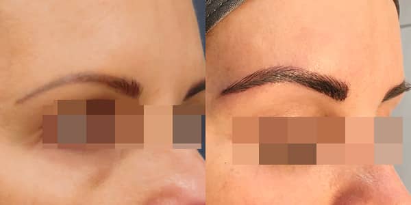 London Cosmetic Tattooing - Eye Brow