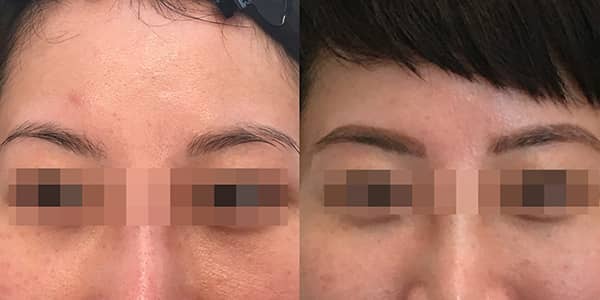 Korean Microblading Eyebrow London