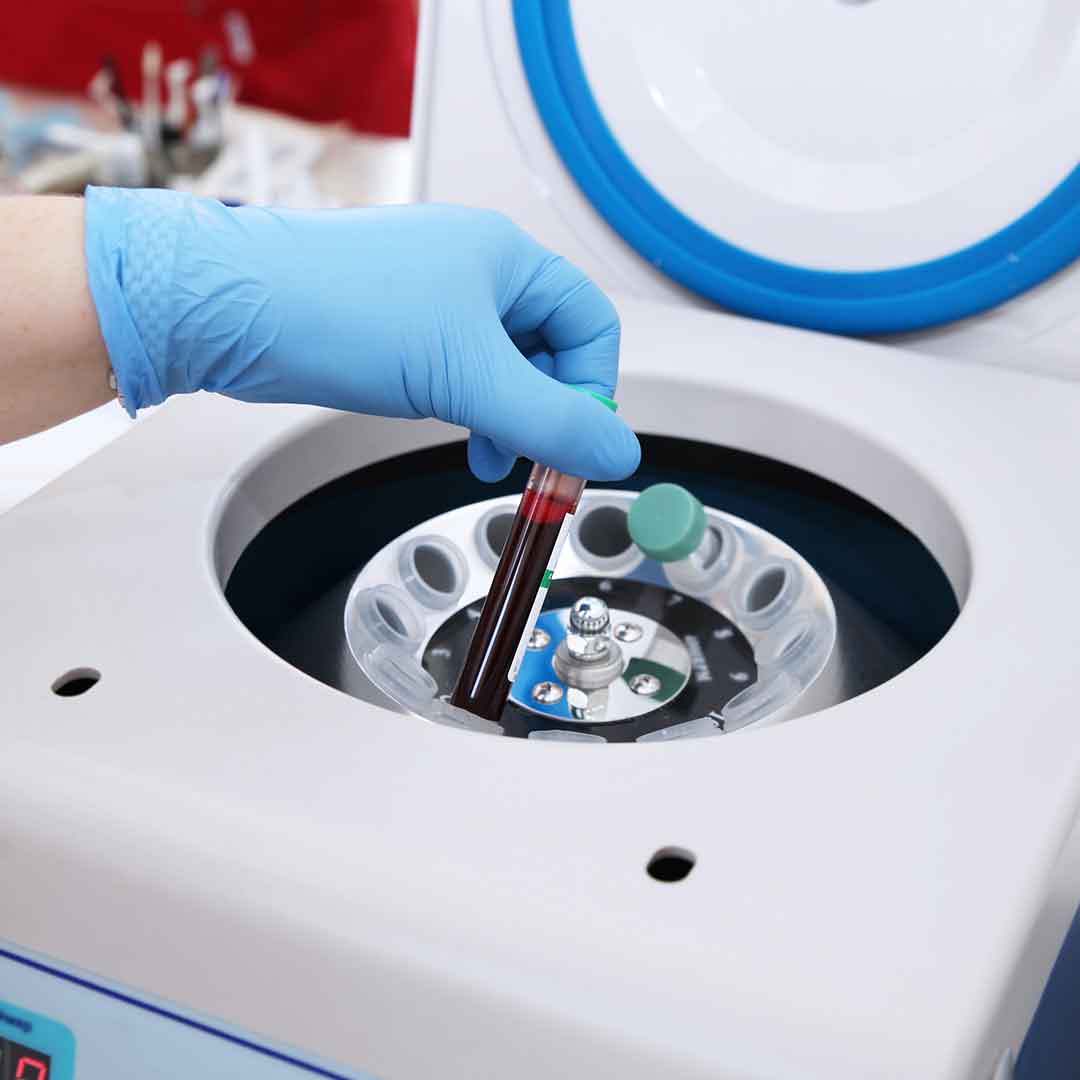 PRP Spinner