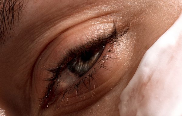 under eye wrinkles