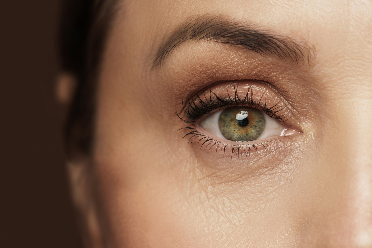 Treating Under Eye Wrinkles