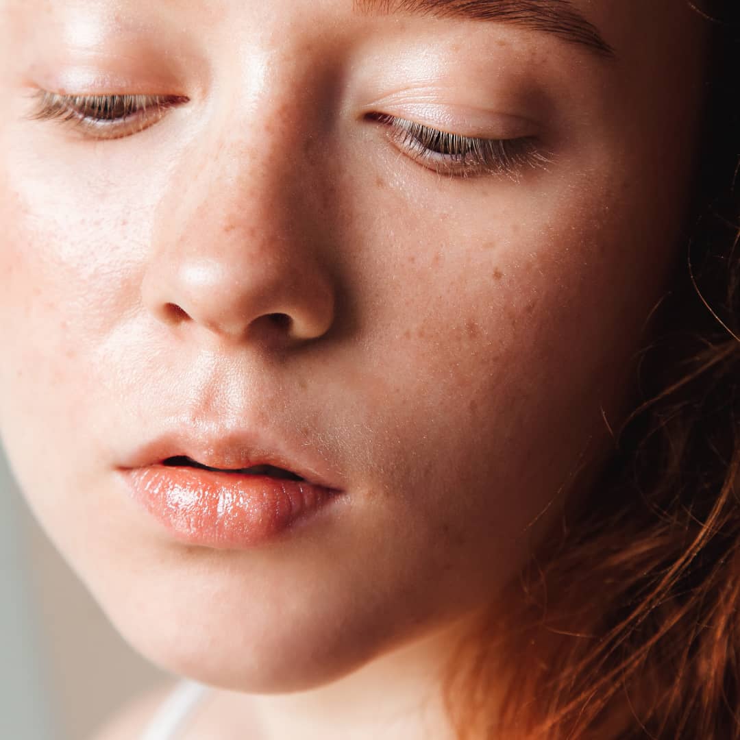 What is Cosmelan Peel