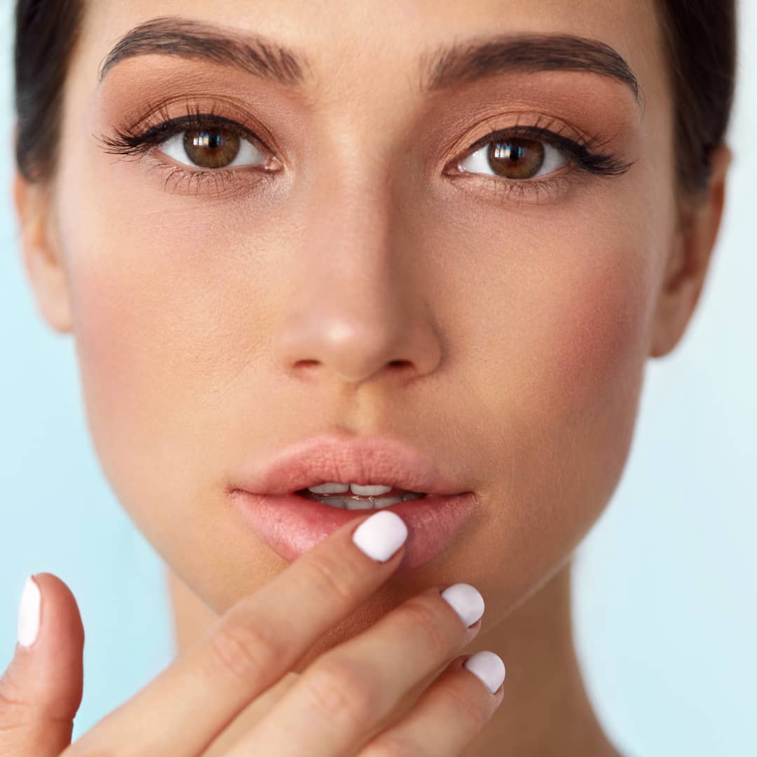 Post-Bullhorn-Lip-lift-surgery