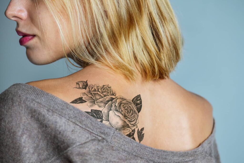Cosmetic Tattoo Removal London