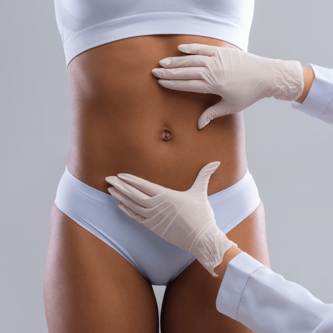 Mini-Tummy Tuck V.S Tummy Tuck