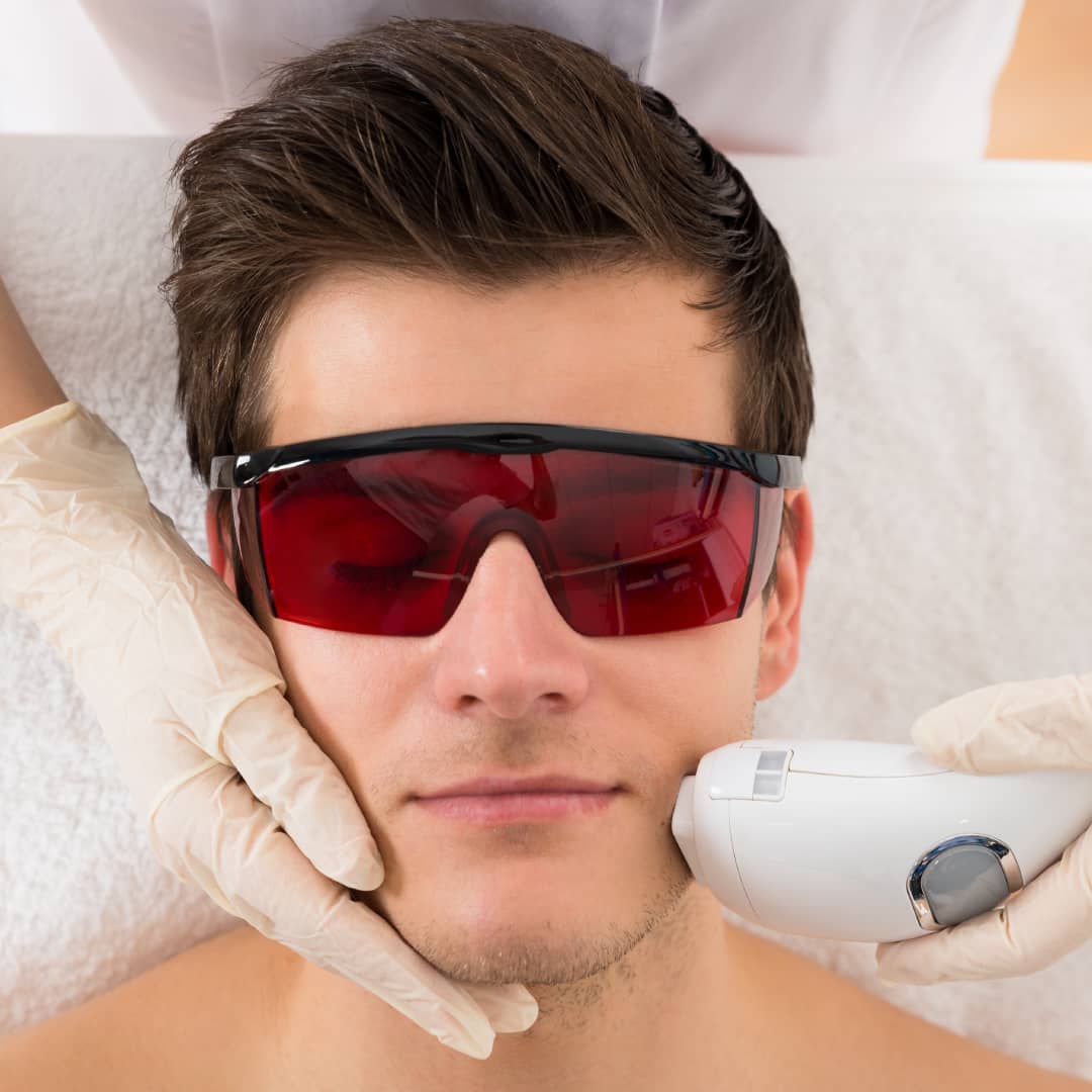 men having ClearLift for blackheads