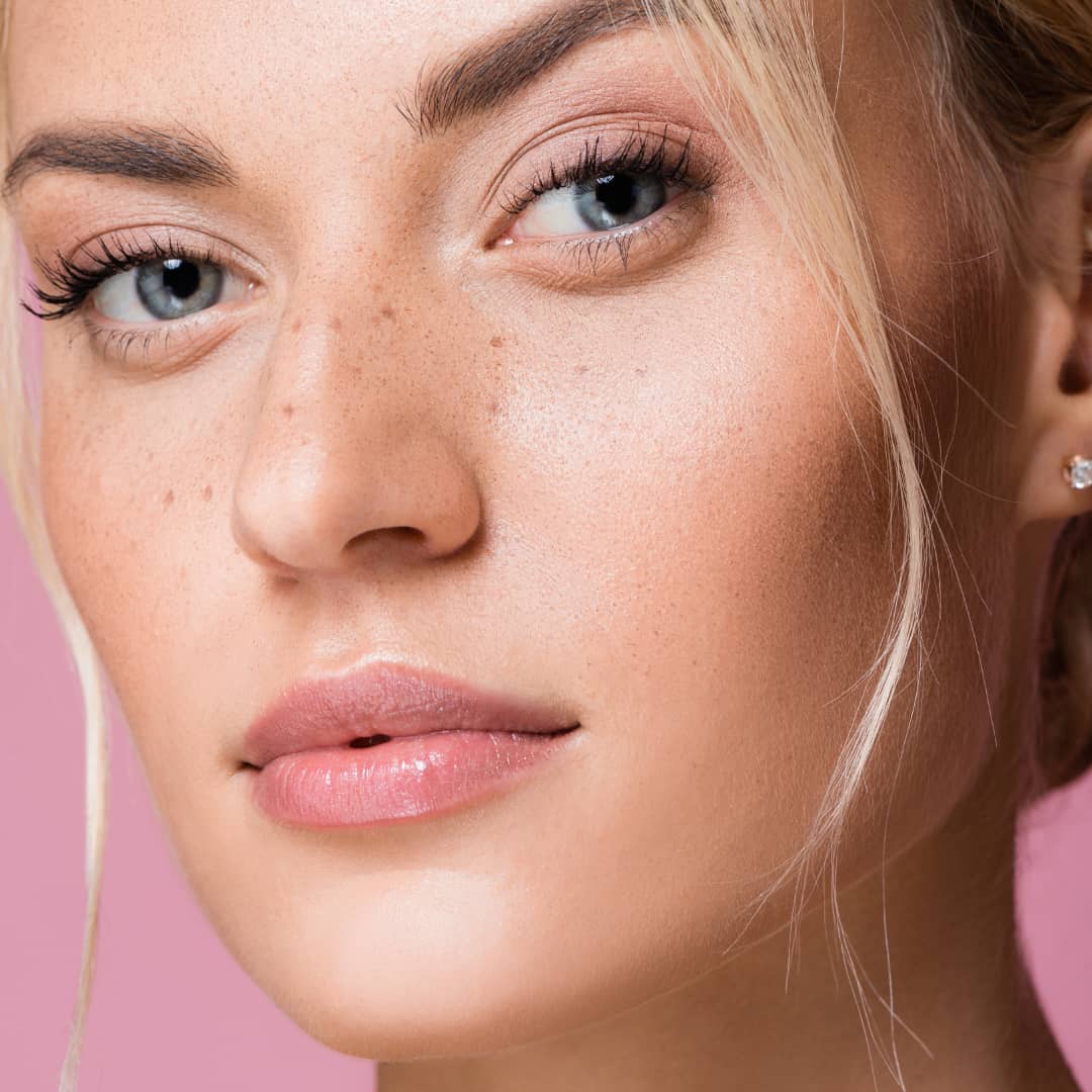 Chemical skin Peel for pigmentation