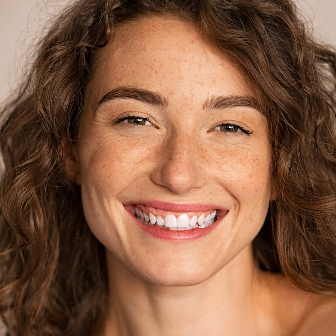 Dye-VL for pigmentation