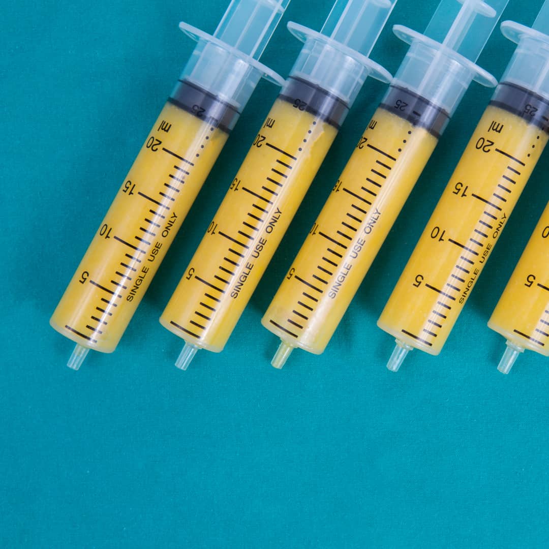 Fat Transfer to Breast London