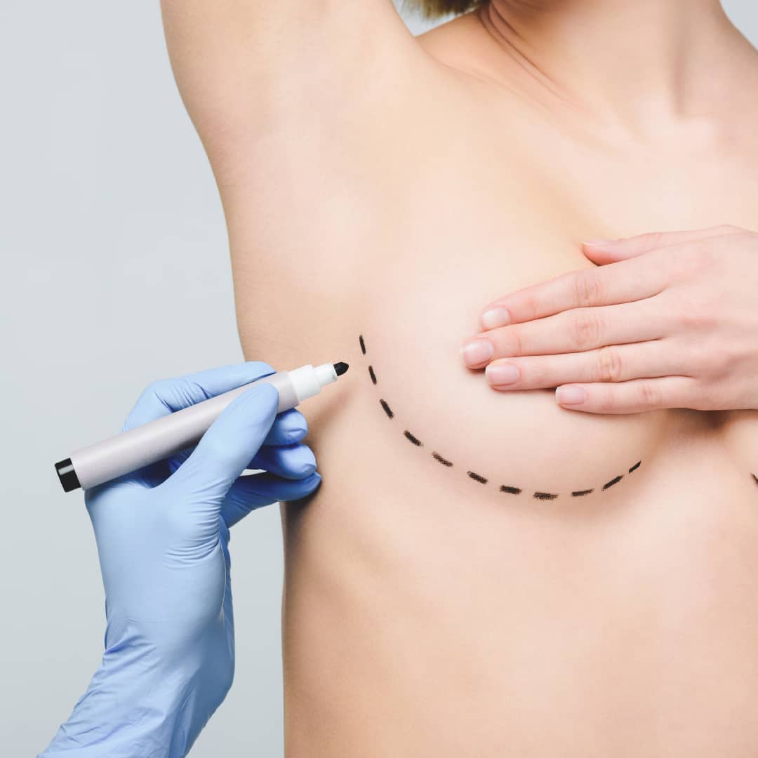 Risks and complications of Breast Augmentations
