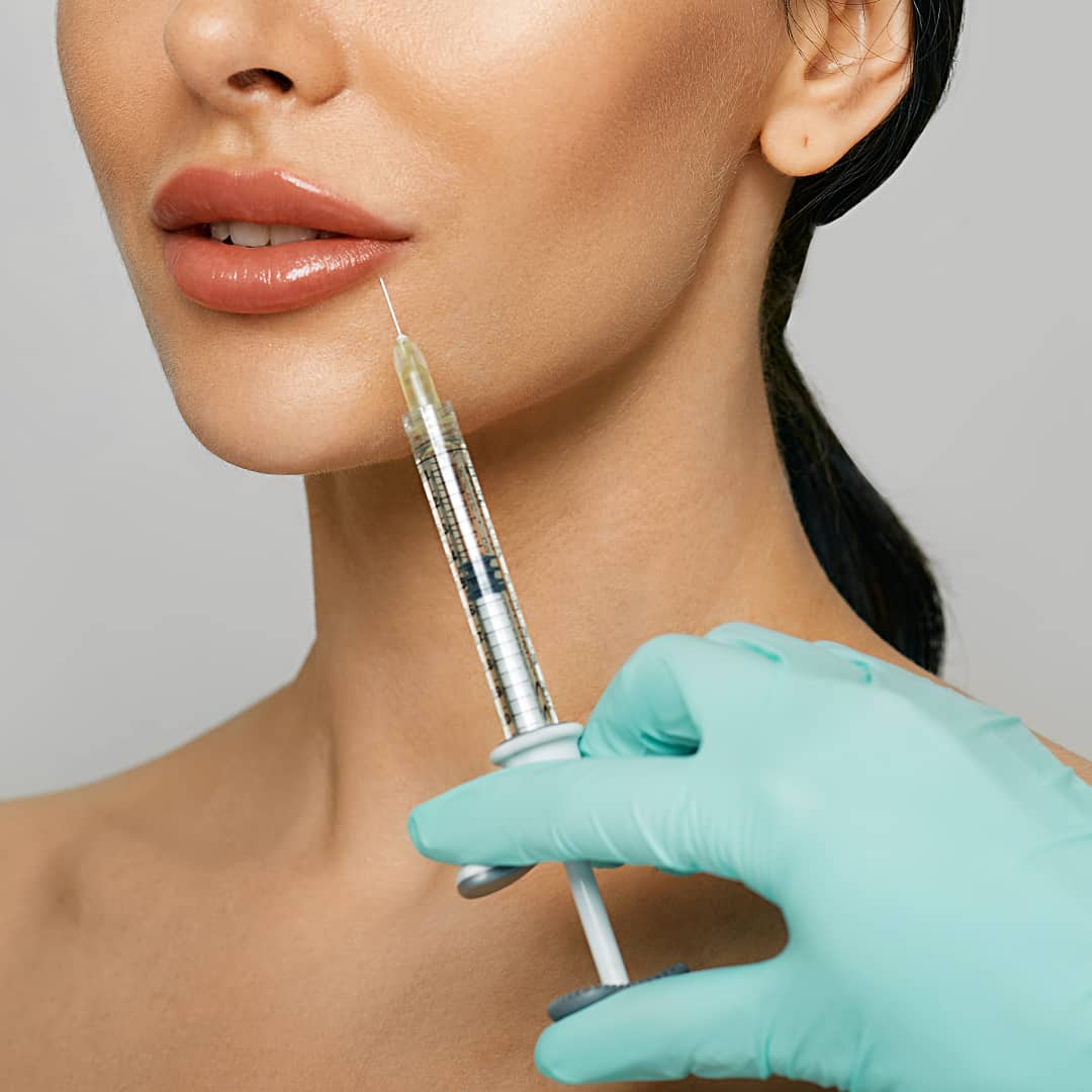 Lip Flip VS Lip Filler