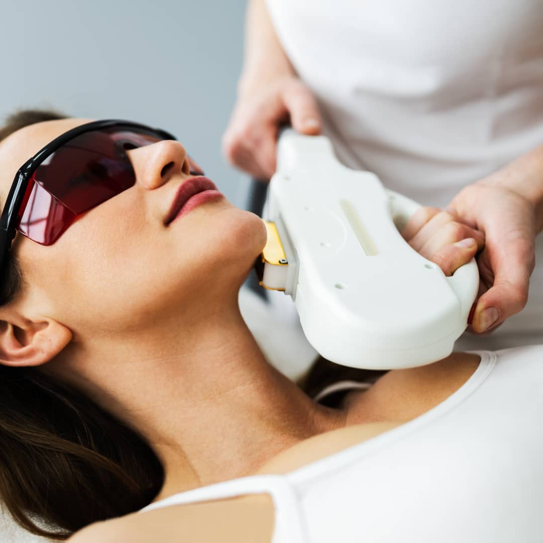 Treatment for Rosacea
