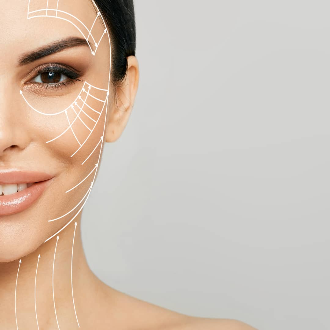 What is PDO Threads Lift