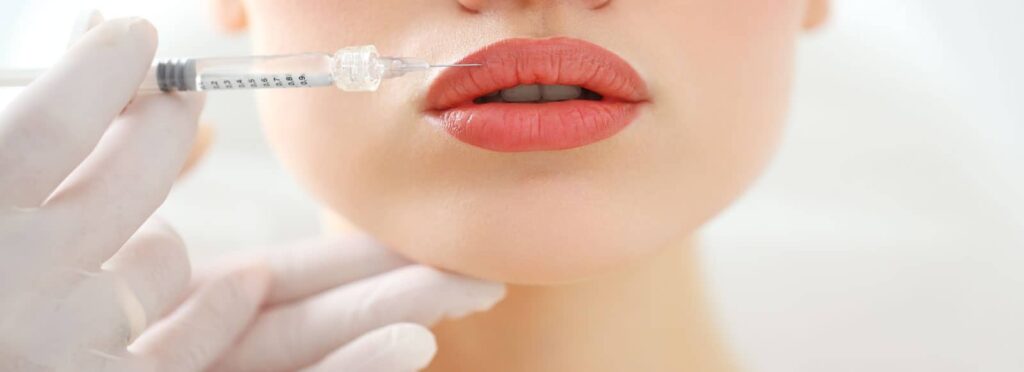 Lip Fillers London