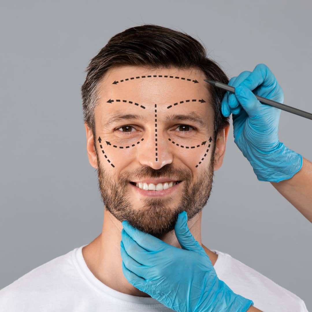Y Facelift For Men