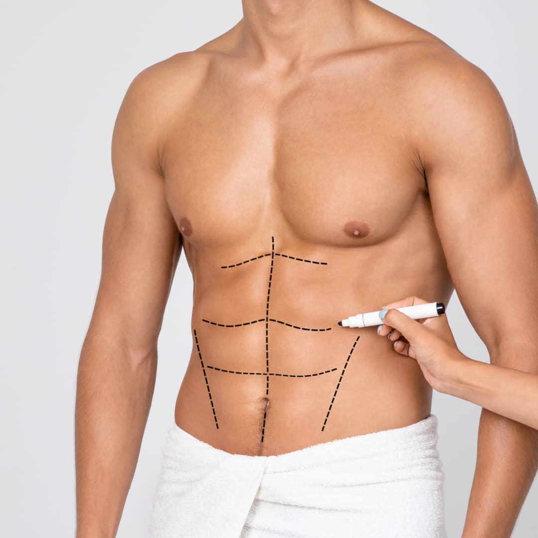 Liposuction for removing man boobs
