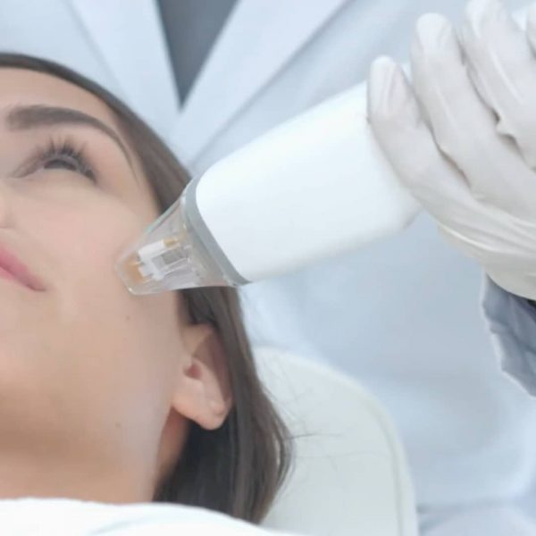 Potenza-RF-Microneedling-rejuvenation