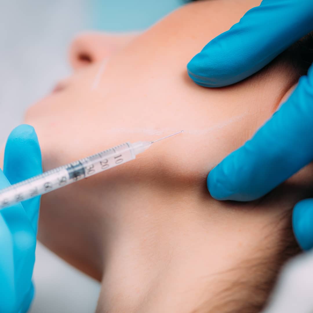 jawline-filler-injections