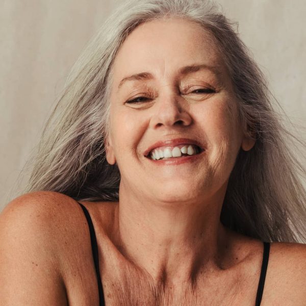 Y Facelift for Lower face