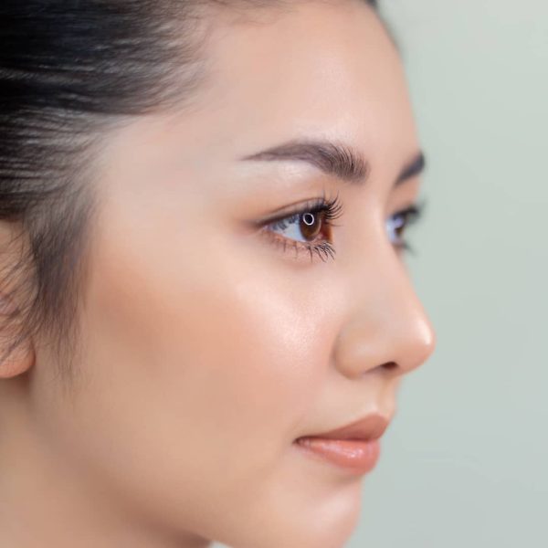 asian-rhinoplasty-and-standard-rhinoplasty