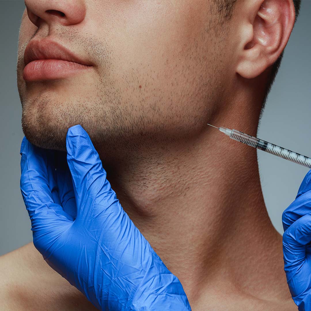 filler injected into man's face