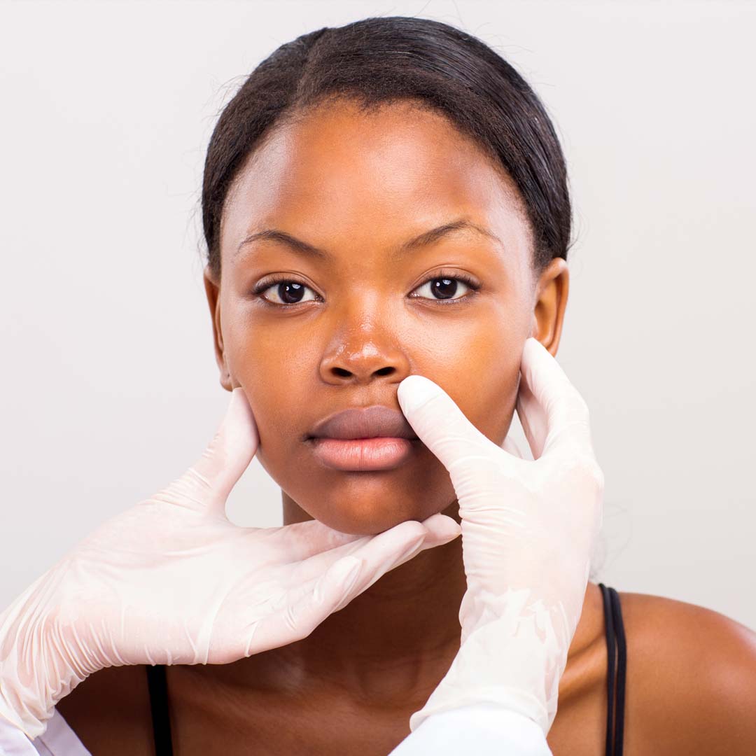 A woman's face skin is being lifted by a pair of gloved hands
