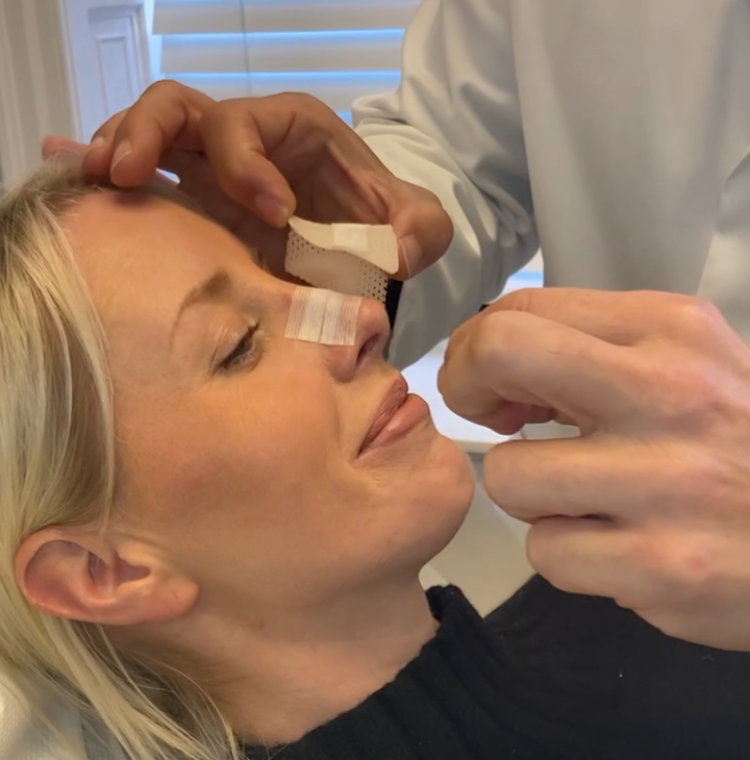 A woman is having her Rhinoplasty nose cast removed