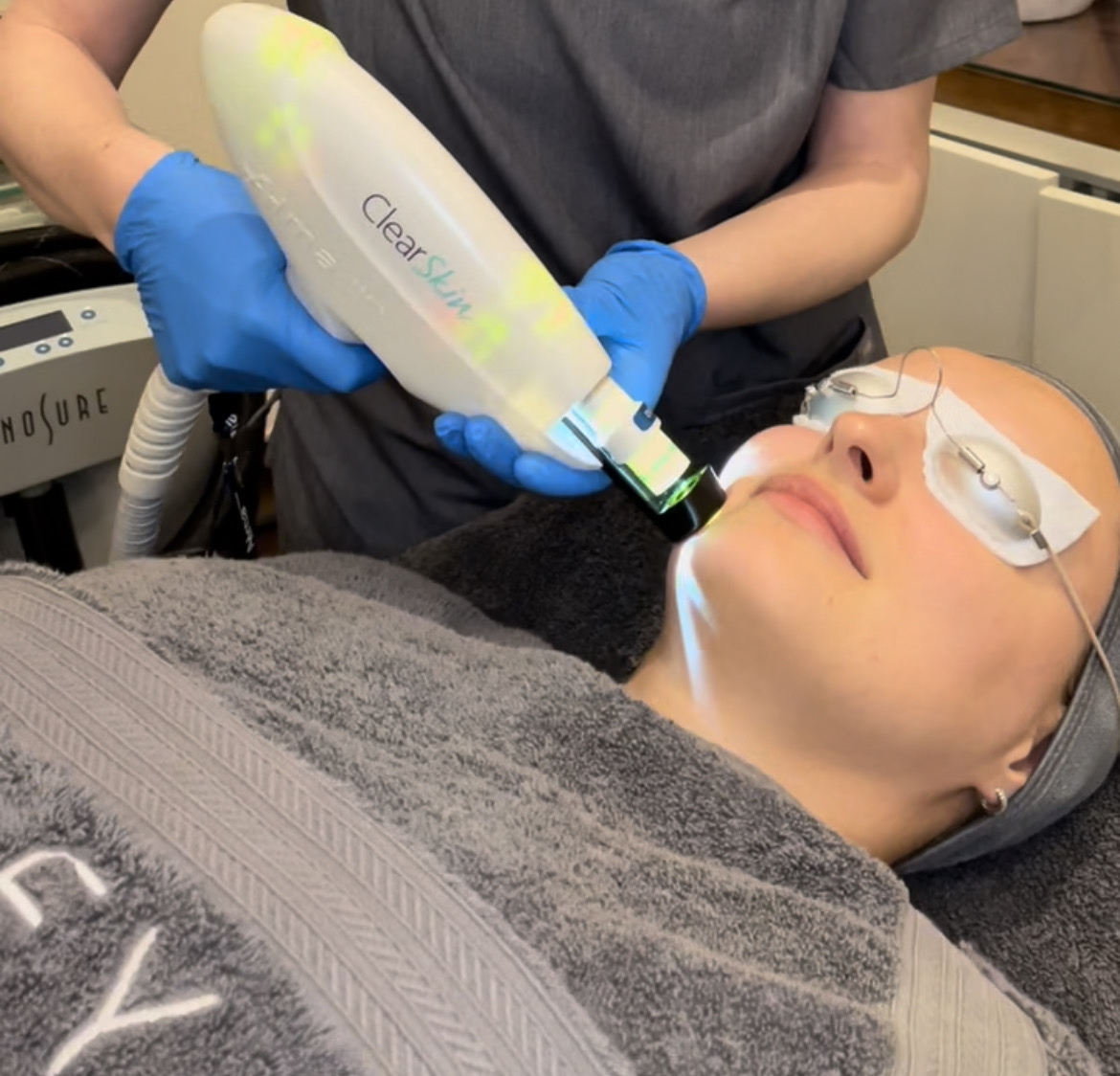 ClearSkin Laser Treatment