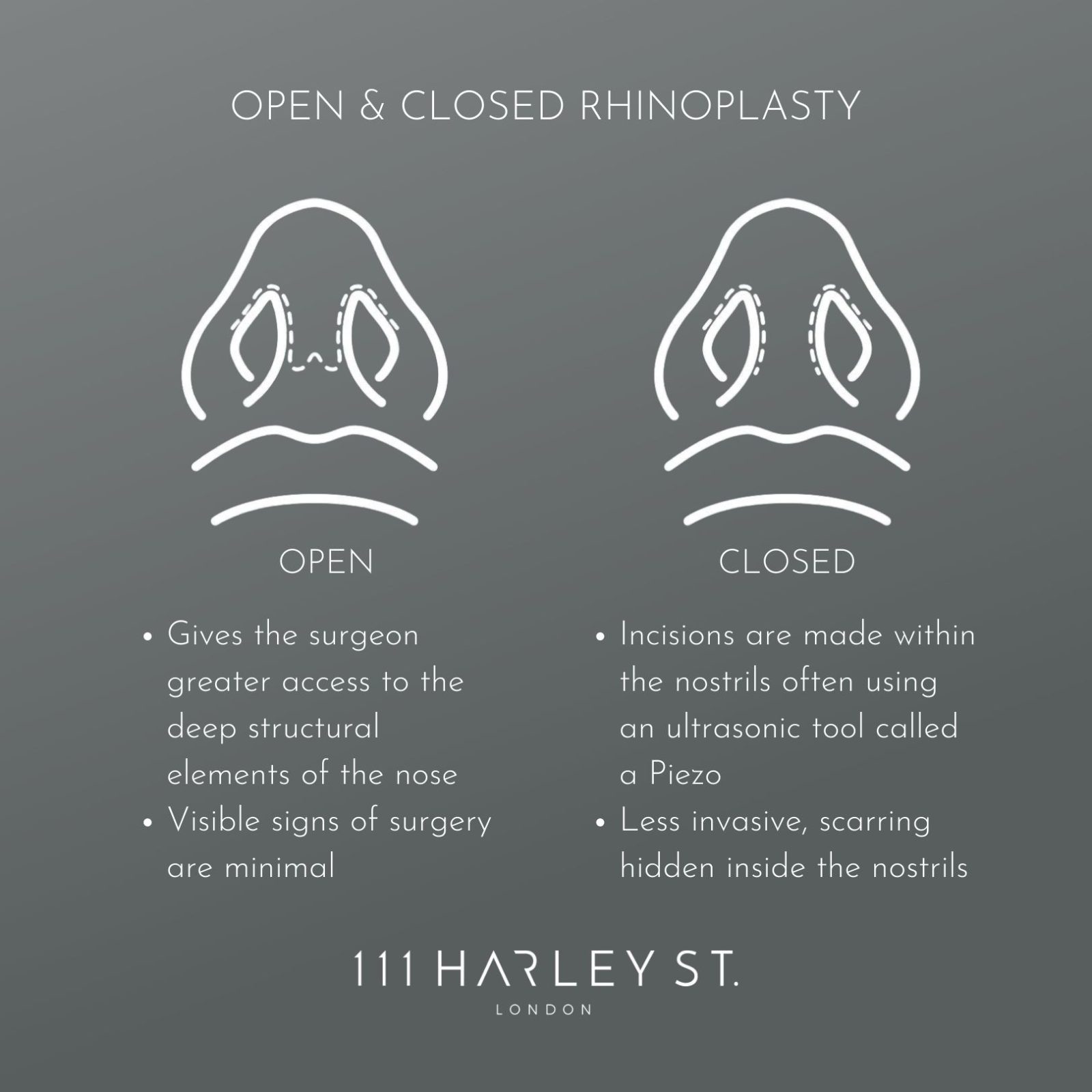 A diagram outlining the difference between an Open and Closed Rhinoplasty